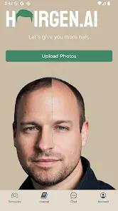Hairgen.ai AI Hair Transplants screenshot